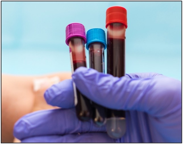 Red Cross Announces Severe Emergency Blood Shortage, Calls on Americans to Donate